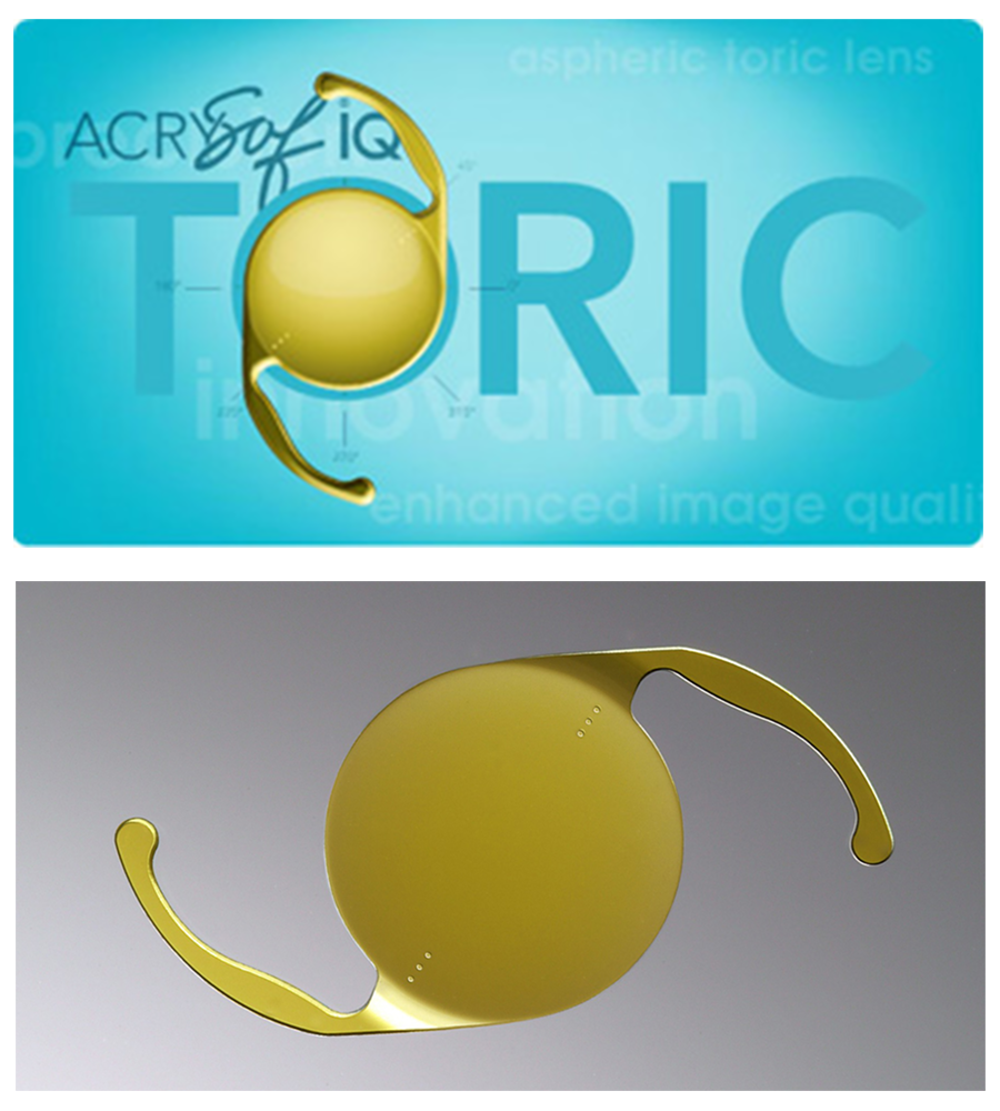 Premium IOL Implants Island Eye Surgery Specialists